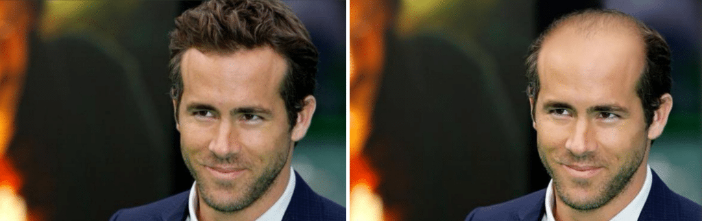 Η αραίωση μαλλιών στο Ryan Reynolds