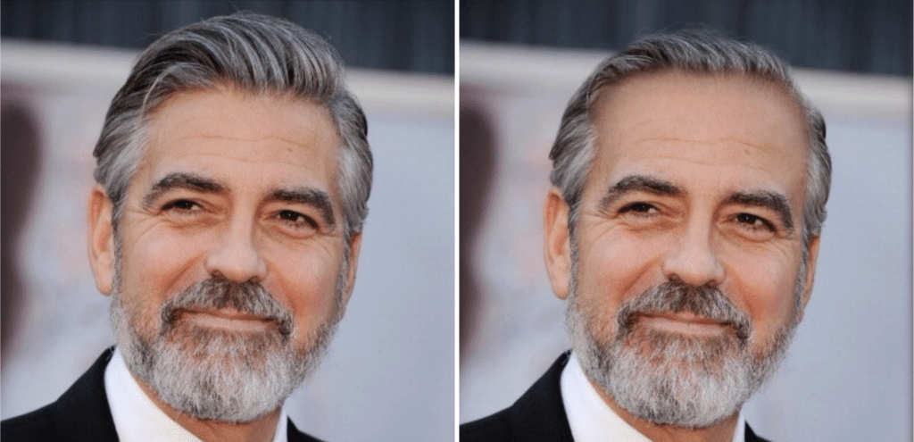 Celebrities χωρίς μαλλιά: George Clooney