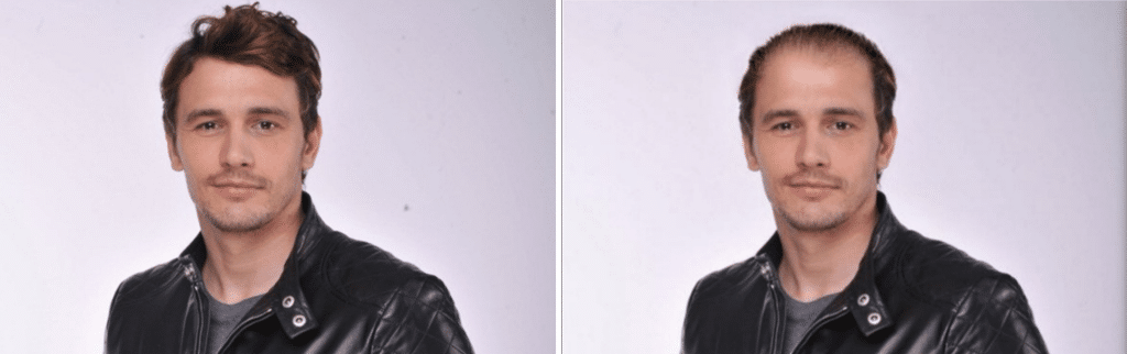 Celebrities χωρίς μαλλιά: James Franco