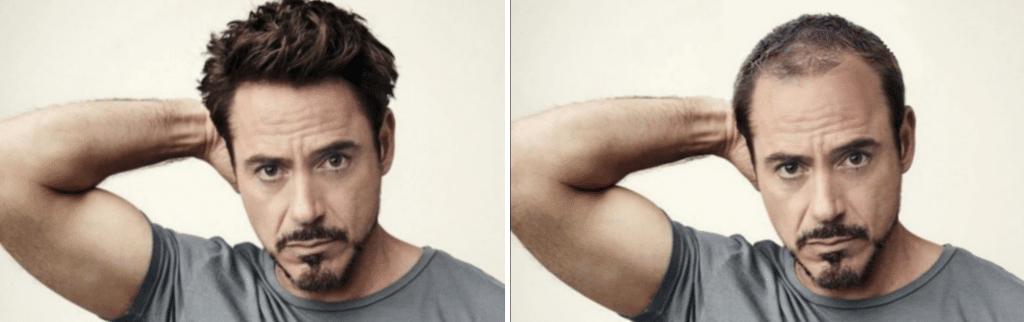 ο Robert Downey Junior με αραίωση μαλλιών