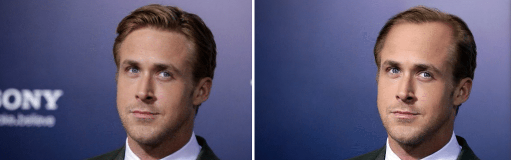 Η τριχόπτωση και ο Ryan Gosling