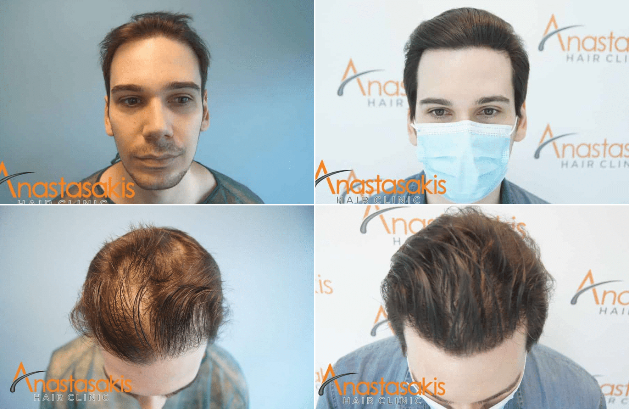 https://anastasakishairclinic.com/portfolio/apotelesma-7-minon-1820-fus/