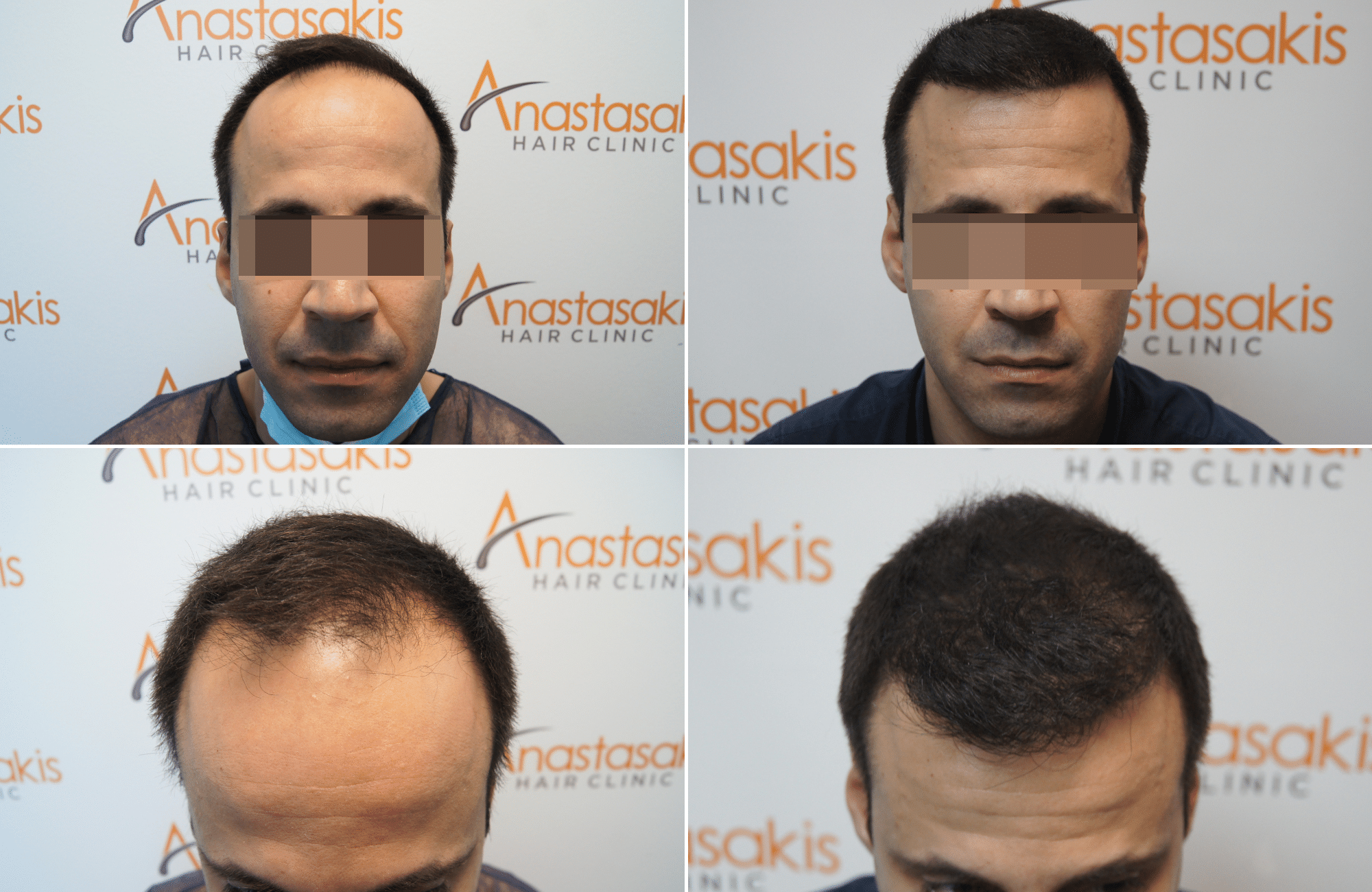https://anastasakishairclinic.com/portfolio/apotelesma-me-3500-fus-3-2/