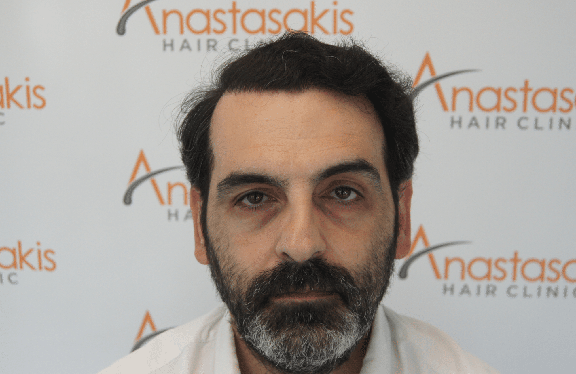 peristatiko repair meta ti metamosxefsi mallion me 3500 fus akoyrefto fullface