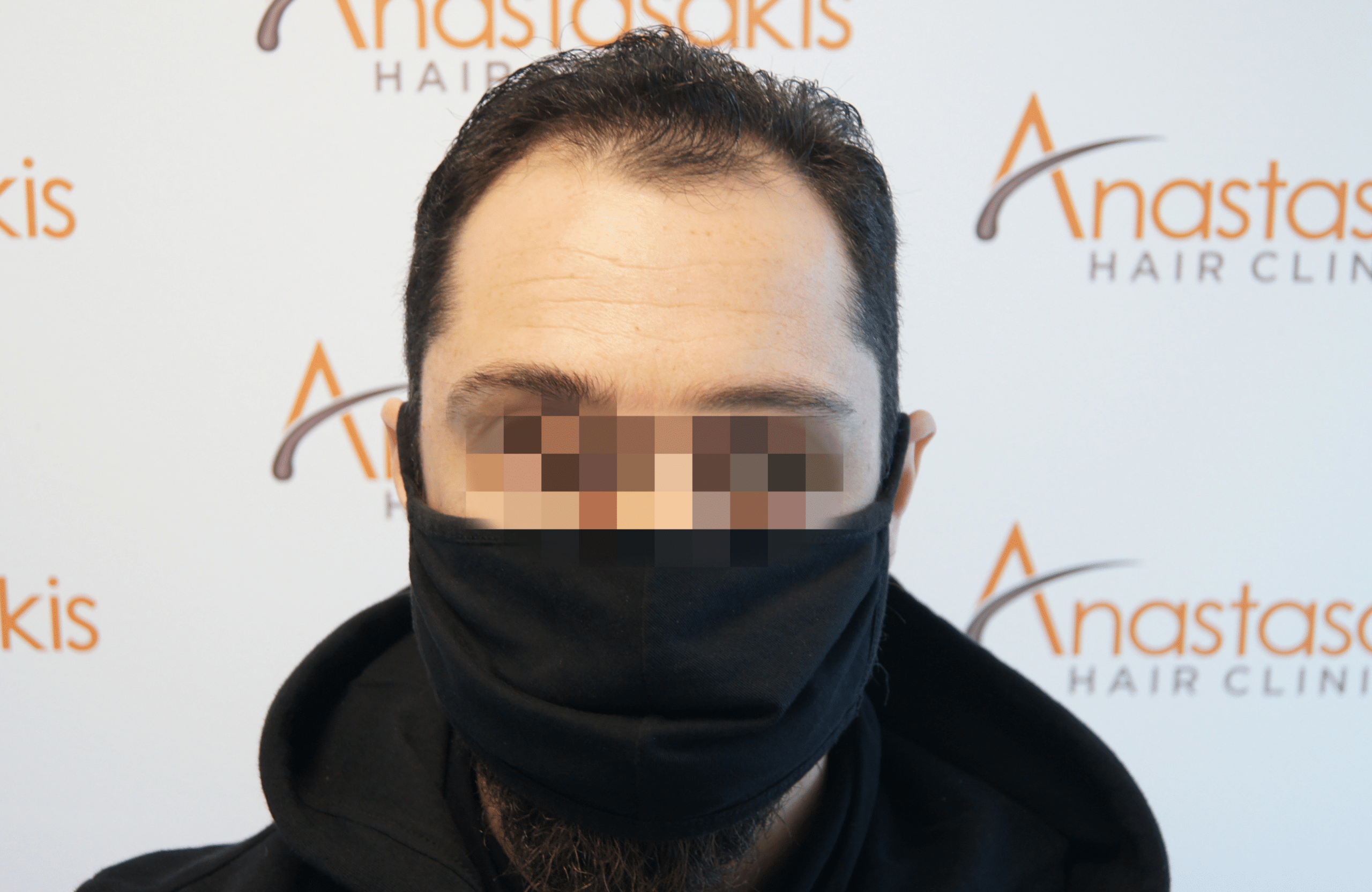 fullface prin apo 2000 fus