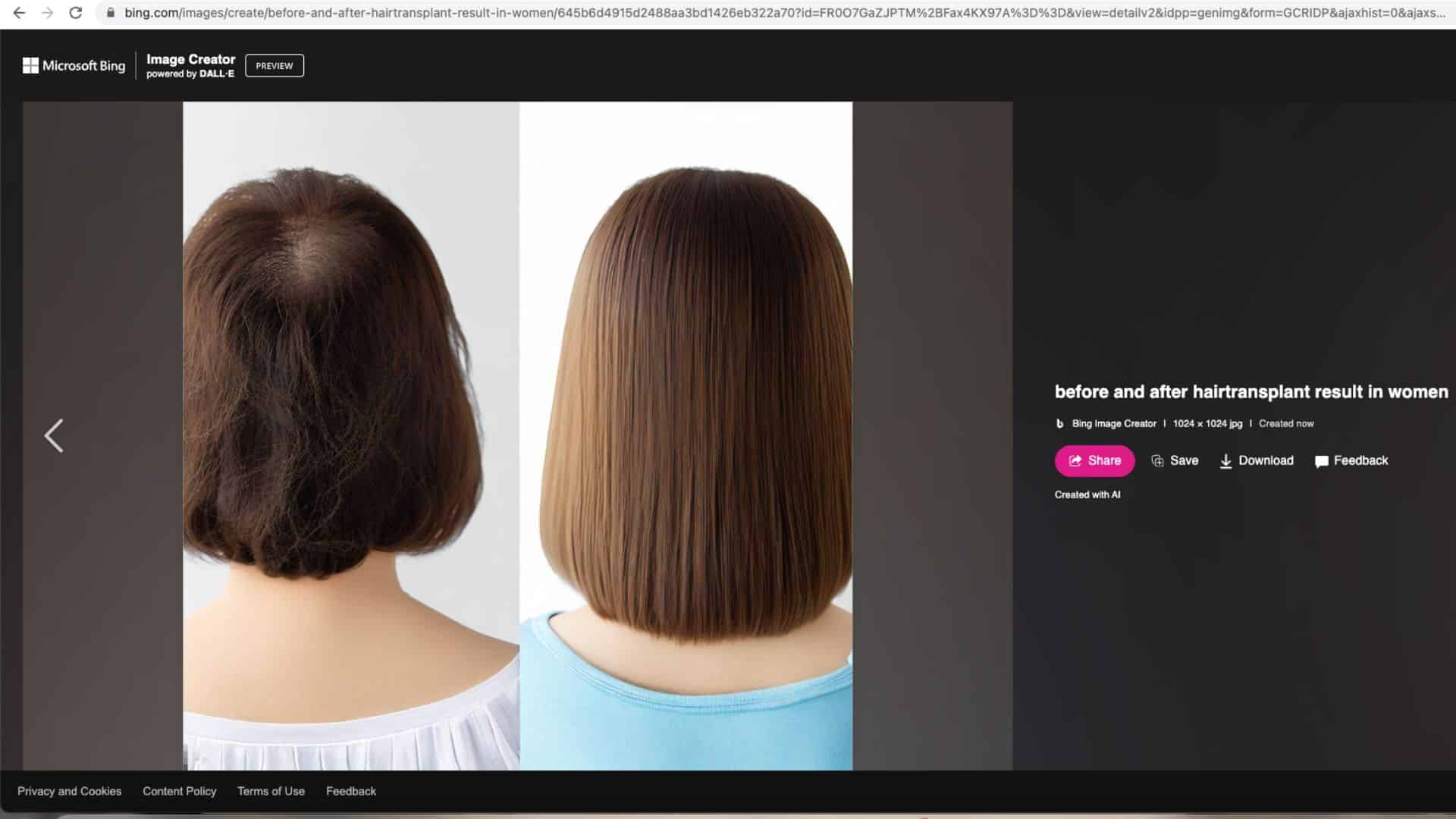 AI in hair Transplantation - AI-generated images
