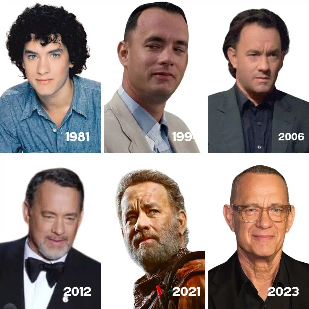 Μεταμόσχευση Μαλλιών του Tom Hanks-οΟι αλλαγες στα μαλλιά του με τον χρόνο