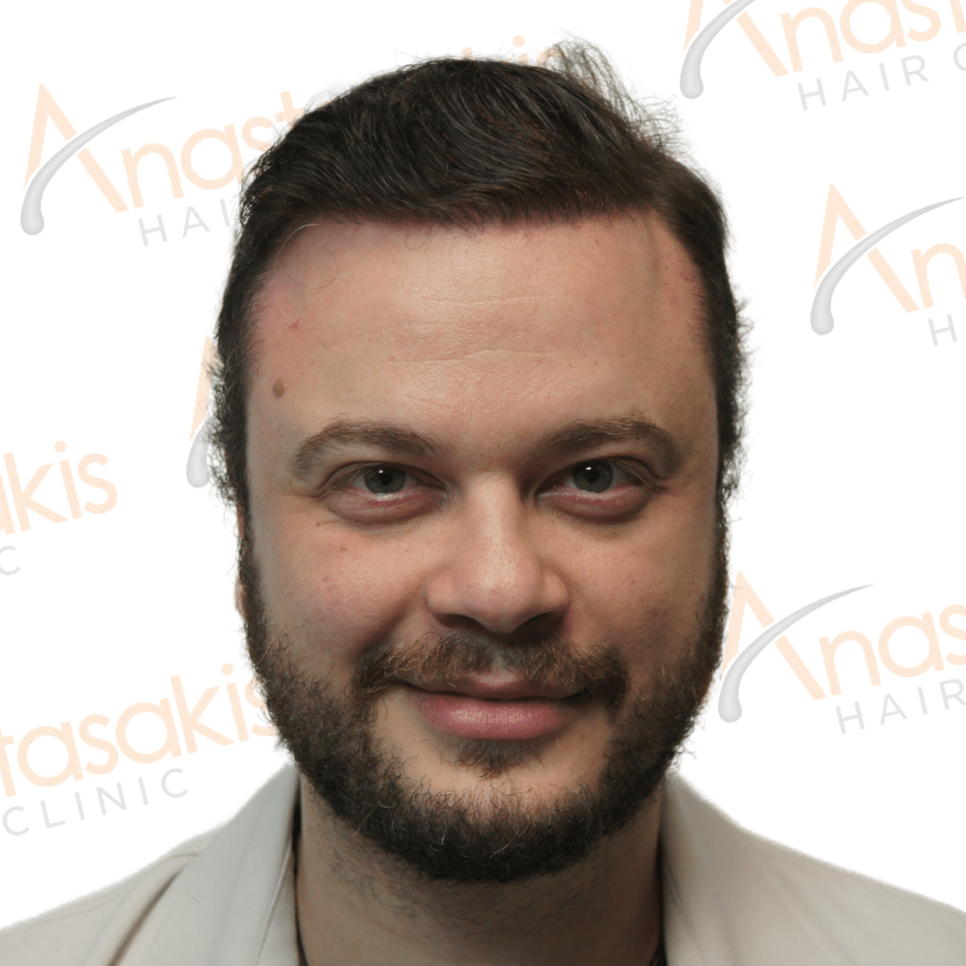Anastasakis Hair Clinic
