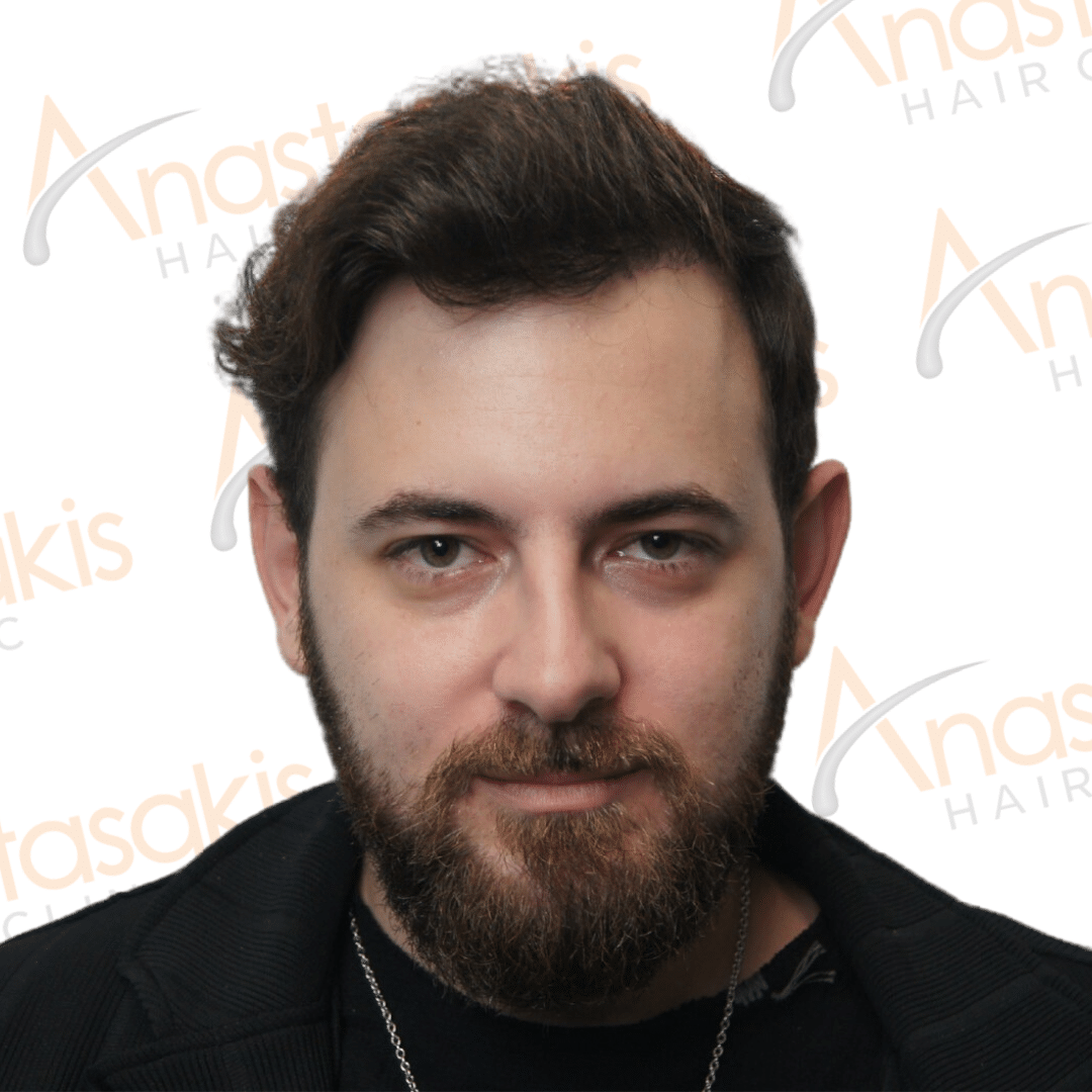 το αποτελεσμα και η προσωπική μαρτυρία του βασίλη για το αποτέλεσμα του