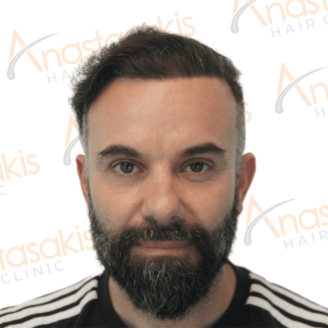 Anastasakis Hair Clinic