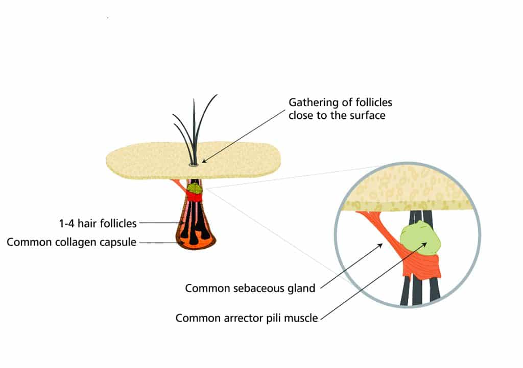 microscopic view of a natural follicular unit